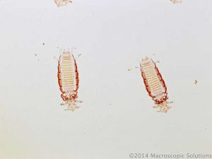 Se débarrasser des poux de corps