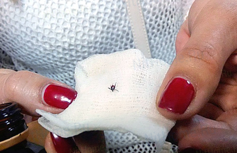 Vous pouvez mettre une tique sur la gaze