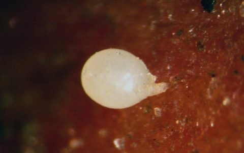 Nématode pâle au microscope