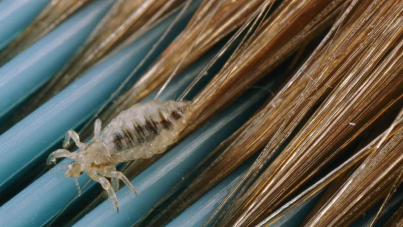 La pédiculose se transmet par un peigne