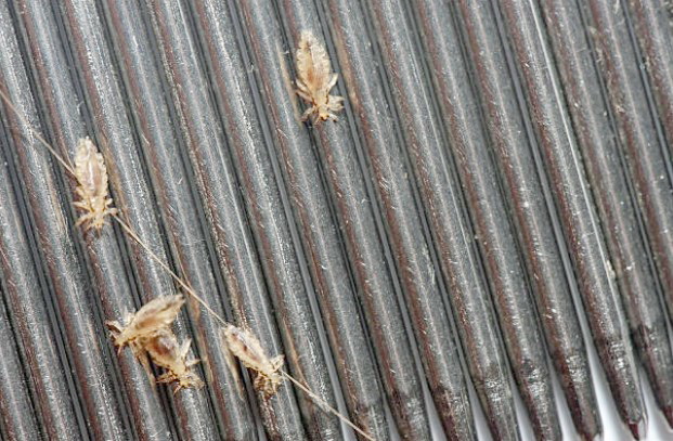 Photo de poux de tête