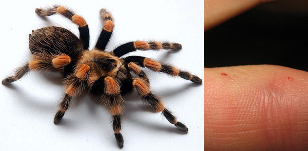 Morsure d'araignée tarentule