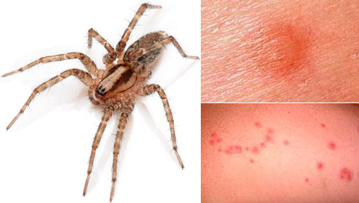 Accueil Spider Bite